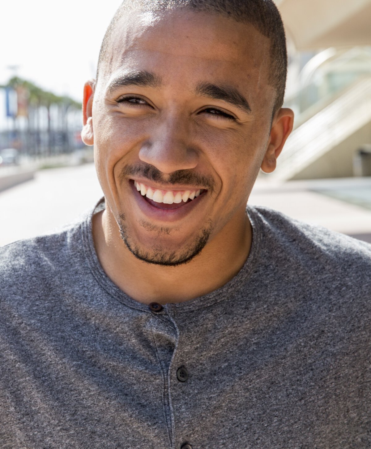 San Diego chronic sinusitis model smiling